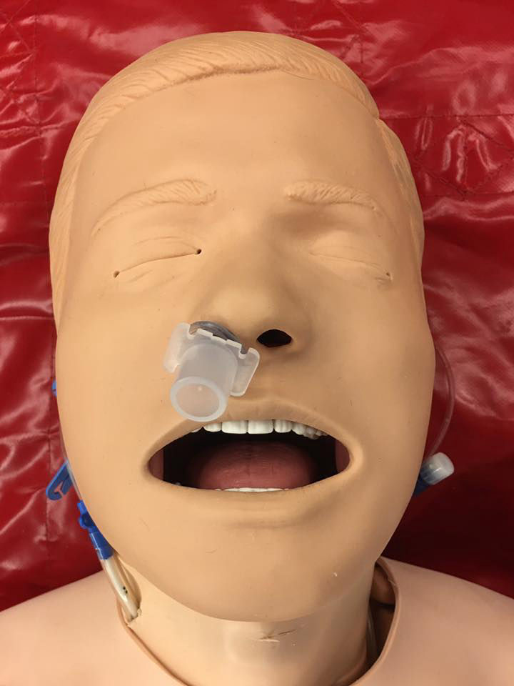 nasal trumpet maneuvre - notfallmedizin.blog