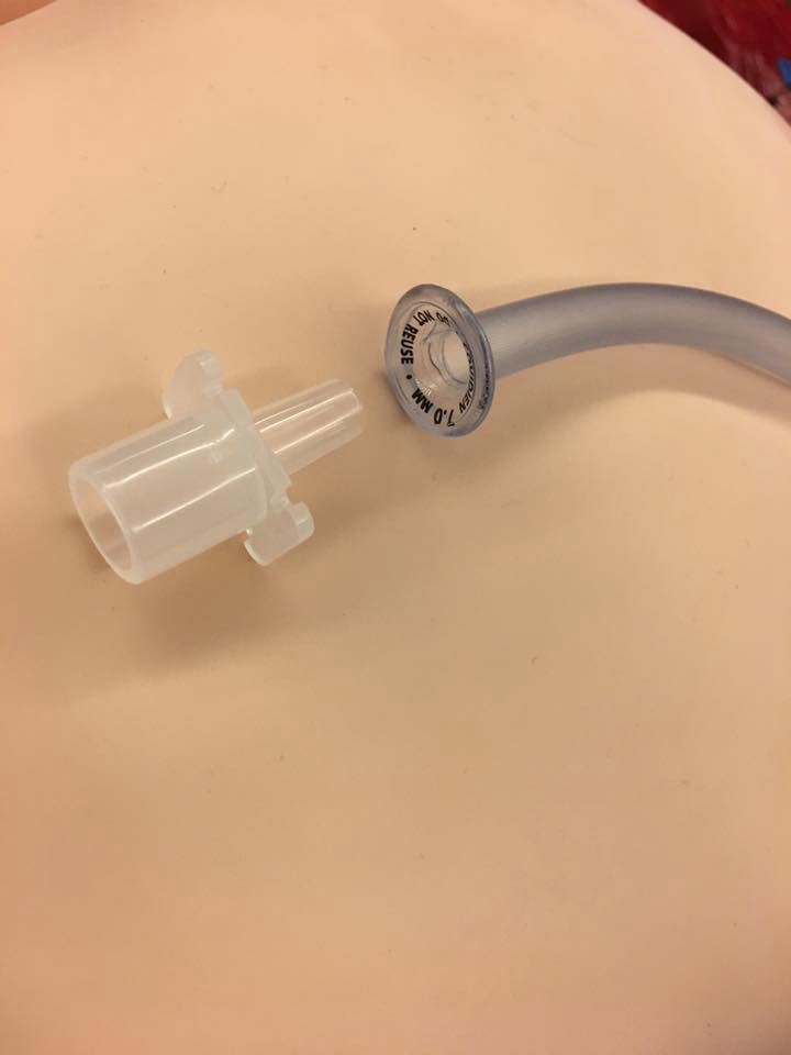 nasal trumpet maneuvre - notfallmedizin.blog