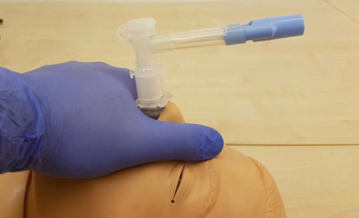 nasal trumpet maneuvre - notfallmedizin.blog