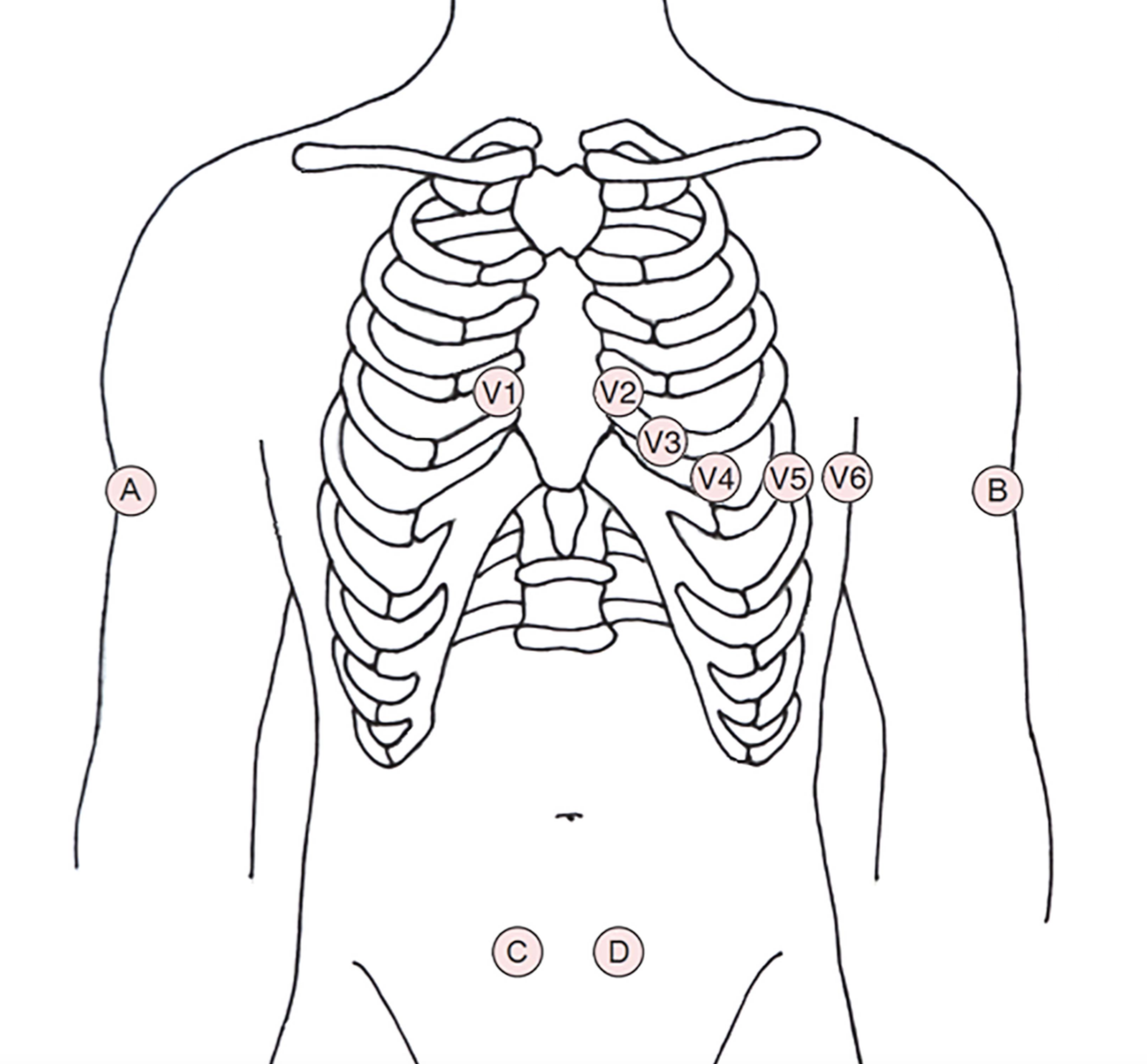 12-Kanal-NEP-EKG - notfallmedizin.blog